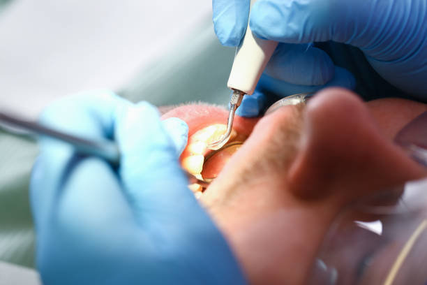 Best Urgent Dental Care for Toothache in West Park, CA